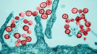 Revelan que el hantavirus puede permanecer oculto en el esperma humano durante años. Revelan que el hantavirus puede permanecer oculto en el esperma humano durante años.