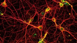 Creíamos que el cerebro adulto ya no podía regenerarse… ahora descubren las células que crean nuevas neuronas. Creíamos que el cerebro adulto ya no podía regenerarse… ahora descubren las células que crean nuevas neuronas.