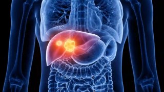 Revelan que un producto químico de limpieza podría estar causando un daño hepático severo. Revelan que un producto químico de limpieza podría estar causando un daño hepático