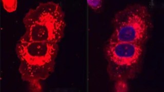 Descubren una forma de destruir las células cancerosas usando “martillos moleculares” activados con luz infrarroja. Descubren una forma de destruir las células cancerosas usando “martillos moleculares” activados con luz infrarroja.