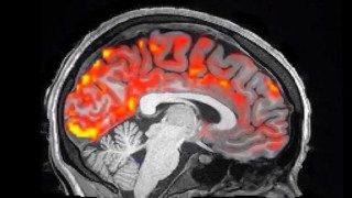 Un hábito cotidiano que parece inofensivo podría estar reduciendo el volumen de tu cerebro sin que lo notes. Un hábito cotidiano que parece inofensivo podría estar reduciendo el volumen de tu cerebro sin que lo notes.