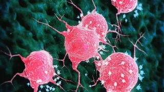 Uno de los azúcares más consumidos podría facilitar la propagación del cáncer de ovario después de la quimioterapia. Uno de los azúcares más consumidos podría facilitar la propagación del cáncer de ovario después de la quimioterapia.